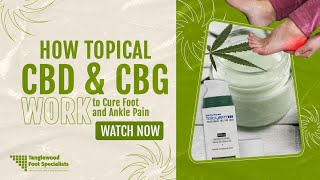 How Topical CBD and CBG Work to Cure Foot and Ankle Pain