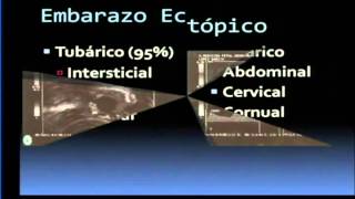 HEMORRAGIA DE LA PRIMERA MITAD DEL EMBARAZO