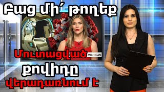 ԱՄՆ-ում քովիդը վերադառնում է նոր շտամով, իսկ Ռուսաստանը անմահության պարկուճ է ստեղծում