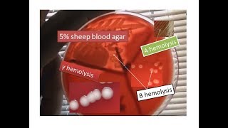 Blood agar showing alpha, beta and gamma hemolysis | Use of blood agar