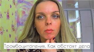 Тромбоцитопения. Чем лечу, как моё состояние сегодня. Год болезни за 10 минут. Синяки. (((