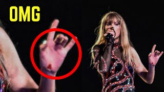 Taylor Swift Suffered A HORRIFYING Hand Injury Recently..😱😣