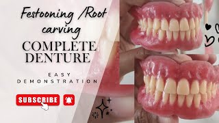 Festooning / Root Carving in Complete Dentures | Step-by-Step Demonstration