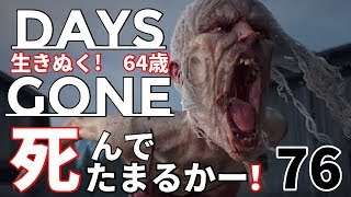 #76 DAYS GONE （デイズゴーン）ゾンビ大好きおばさんの「かかって来いやっ！」