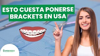 😁🤑 ¿Cuánto CUESTA ponerse BRACKETS en Estados Unidos? 😁🤑