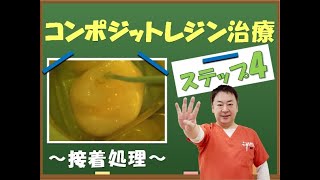 コンポジットレジン治療の流れ④【王子本町歯科クリニック】