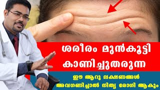 ഒരു കാരണവശാലും അവഗണിക്കാൻ പാടില്ലാത്ത ശരീരം കാണിച്ചുതരുന്ന മുന്നറിയിപ്പുകൾ /Baiju's Vlogs /Dr.Manoj