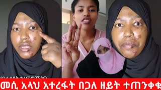 የጋለ ዘይት ተርጭቶብኝ አላህ አተረፈኝ በስደት ያላችሁ  ተጠንቀቁ#habesha #ዱባይ #ሰኡዲ