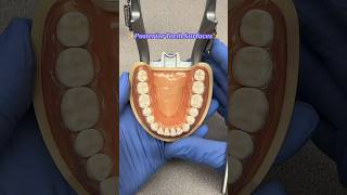Posterior Tooth Surfaces #dentist #dentalassistant