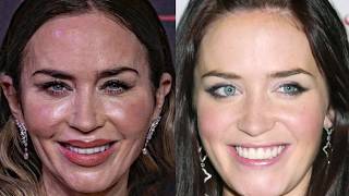 Before & After Photos Of Celebrities Who Regret Their Plastic Surgery