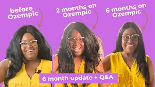 Ozempic 6 month update - everything to know from a patient on weight loss, nausea, dosage, diabetes