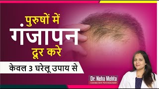 3 Home Remedies to Stop Hairfall in Men- Dr Neha Mehta