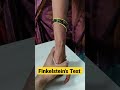 finkelstein s test ..dr sai chandra