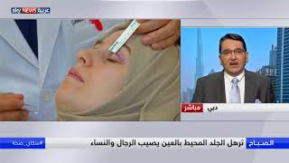 الجراحة التجميلية.. وشد الجفون