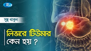 লিভারে টিউমার কেন হয় ? Why are tumors in the liver? Sustho Thakun | Rtv Health Program