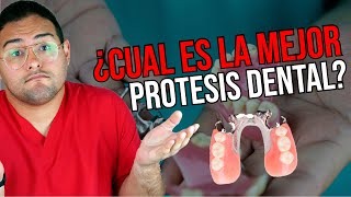 ¿NECESITAS PRÓTESIS DENTAL? 👅 ¡Deberías ver este vídeo! Ft @Dentalk