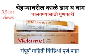 melamet cream Review||best cream for melasma and black spots on face..