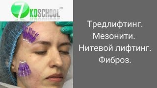 Тредлифтинг. Фиброз. Нитевой лифтинг. Мезонити. Коги. Мнение.