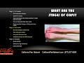 rsd u0026 crps overview from a los angeles pain management clinic