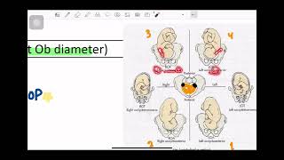 Abnormal presentations