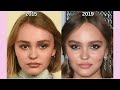 Has Plastic Surgery Prematurely Aged Lily Rose Depp