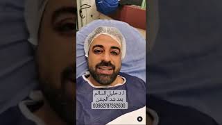 بعد عملية شد الجفن مناشره ، نتائج مبهرة . ا.د. خليل السالم