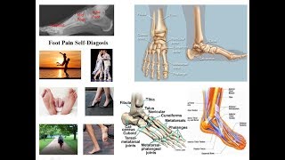 Self-Diagnosis of Foot Pain and Disorders