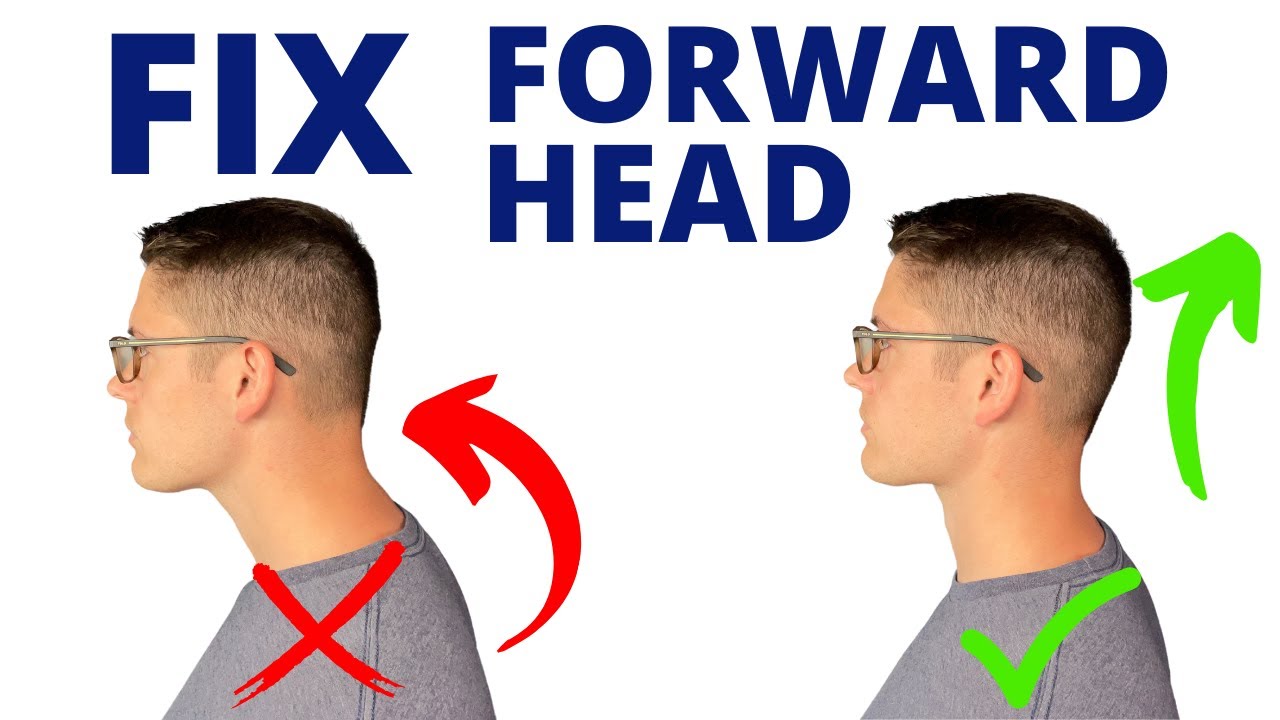 How To Fix Forward Head Posture With 3 Easy Moves - YouTube