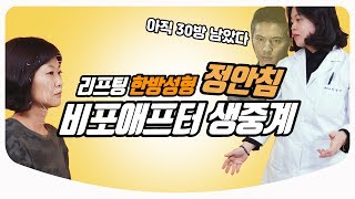 얼굴에 침 70개 꽂아 보았다! 직접 맞아 본 정안침 /한방성형 리프팅 | 한의사 의사친 이정아