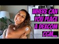 Where Can You Place a Dexcom CGM