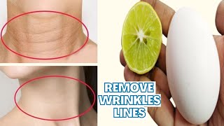 How to remove Neck Wrinkles/Lines permanently | Remove neck lines home remedy | Natural Beauty Tips