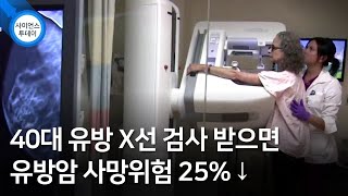 40대 유방 X선 검사 받으면 유방암 사망위험 25%↓ / YTN 사이언스