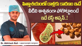 పిత్తాశయంలో రాళ్లకు శాశ్వత చికిత్స | What Causes Gallstones and How to Treat Them | Dr Abhilash Nali