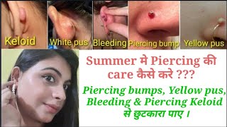 Piercing bumps, Yellow pus, Bleeding, Keloid से कैसे बचे l Piercing Care in Summer l Home remedies l