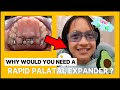 Learn Everything You Need To Know About Rapid Palatal Expander (RPE)