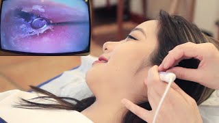 【ASMR】Experience the most professional visual ear cleaning! Dig earwax, relax ear massage!