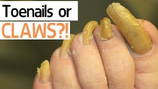 Toenails or Claws?!