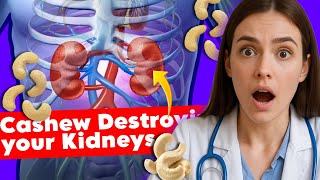 How Cashews can Destroy your Kidneys | Kidney Failure: Doctor Explains