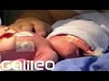 OP im Mutterleib - was wurde aus den Babys? | Galileo