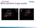 Chison Q9 Comparison with Mindray M7 | Advantage | Color Doppler Ultrasound Scanners