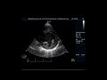 9.40 basics of ultrasound diagnostics in cardiology