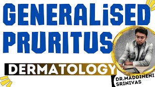 MBBS Dermatology lectures | GENERALISED PRURITUS | ITCHING |Dr Maddineni Srinivas | MSD |