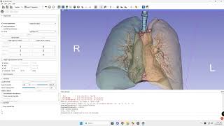 Automatic lung, airway and vesselmask segmentation with Lung CT Segmenter and 3D Slicer