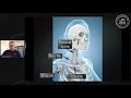 TOS Basics: The Anatomy of Thoracic Outlet Syndrome - Best Video to Begin