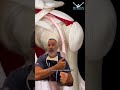 Orthopedic surgeon explains : proximal biceps rupture using 3D4Medical animation #orthopedics