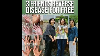 3 Friends Reverse Disease For Free