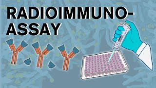 Radioimmunoassay