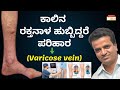 ಕಾಲಿನ ರಕ್ತನಾಳ ಹುಬ್ಬಿದ್ದರೆ ಪರಿಹಾರ (Varicose Vein) - Dr. Raju Krishnamurty