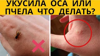 ✅ Что делать если укусила ос. Укус осы в домашних условиях. Помощь при укусе осы