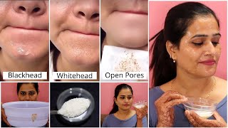 Blackhead, पिगमेंटेशन, Whitehead व दाग धब्बे हटाने का रामबाण इलाज, Get spotless \u0026 Glowing Skin fast